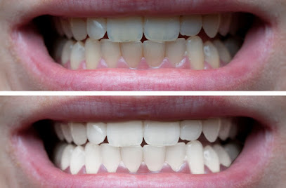 Heather Ridge Dentistry - Dental Implant - Invisalign Dentist - Laguna Niguel Dentist