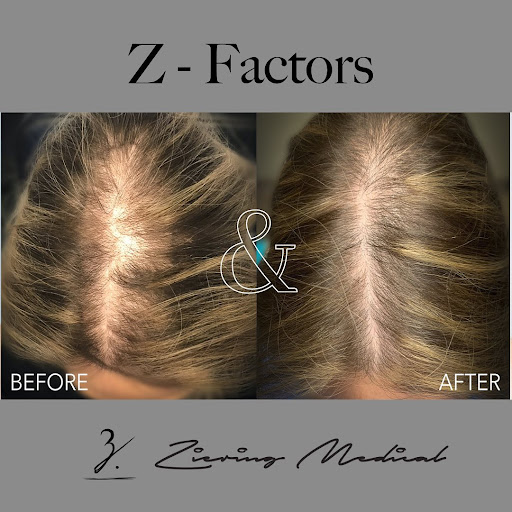 Ziering Medical Hair Restoration Beverly Hills image