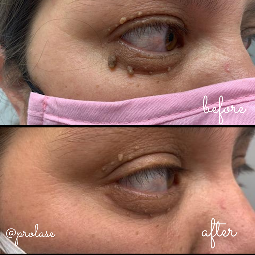 Explore noah tattoo ideas, creative tattoo ideas in Glendale, available at Prolase