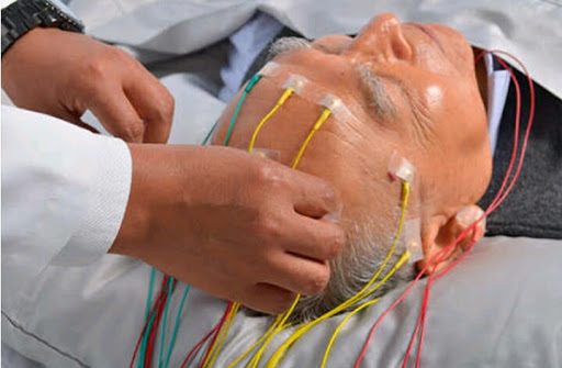 Electromiografia y electroencefalograma Dr. Adrián Reséndiz