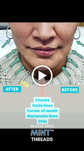 Explore 777 tattoo ideas, creative tattoo ideas in Lake Oswego, available at Lake Oswego Vein and Aesthetic LOVA