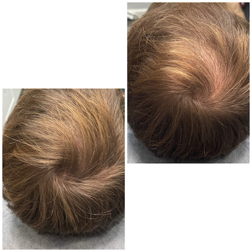 Find in between breast tattoo ideas for your next unique tattoo in Roseville at NuHair Ink. Scalp MicroPigmentation & Aesthetic Clinic of Sacramento