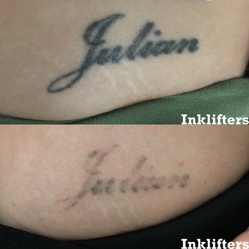 Explore booty cheek tattoo ideas, creative tattoo ideas in Pleasant Grove, available at Inklifters Tattoo Removal