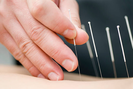 Dana Acupuncture