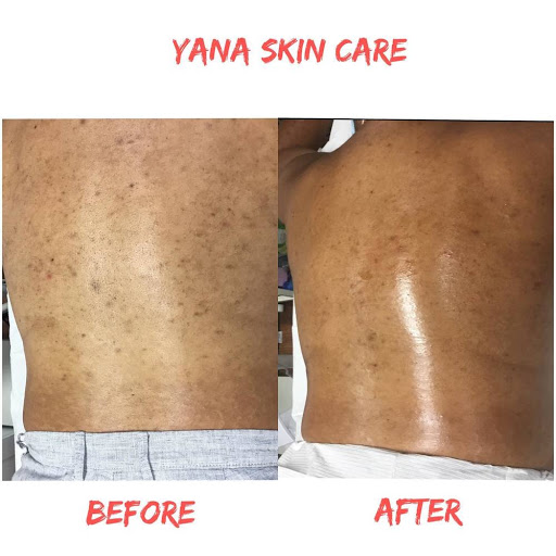 Laser Hair Removal Service «Yana Skin Care», reviews and photos, 3101 Richmond Ave #200, Houston, TX 77098, USA