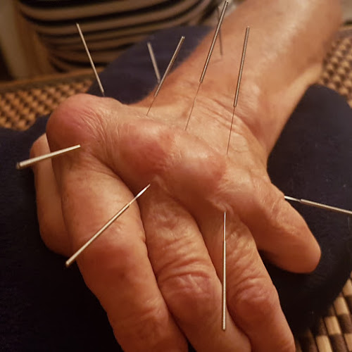 Wassim Acupuncture - Huisarts