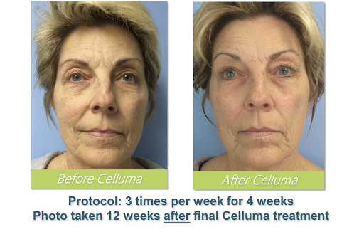 Day Spa «La Estetica Wellness Spa», reviews and photos, 424 N San Mateo Dr #500, San Mateo, CA 94401, USA