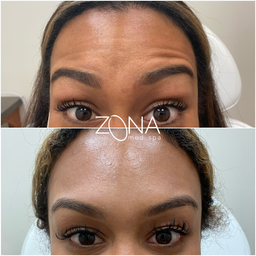 Skin Care Clinic «ZONA MED SPA», reviews and photos, 9767 N 91st St #102, Scottsdale, AZ 85258, USA