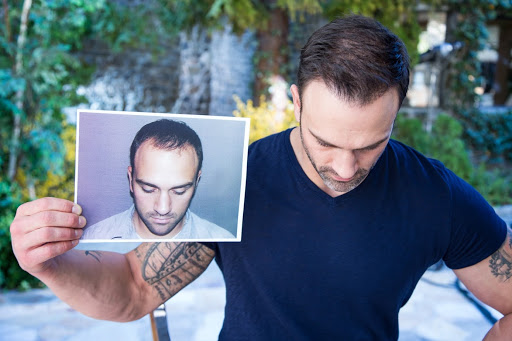 Hair Transplantation Clinic «Bosley Medical - Denver», reviews and photos, 6979 S Holly Cir #275, Centennial, CO 80112, USA