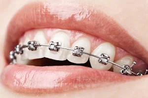 Harkirpa Dental Clinic-Best Orthodontic Clinic/Braces/Implant/Fix Teeth Specialist in Adampur image