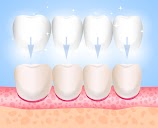 Clínica Dental Tarancón - Implantostetic en Tarancón