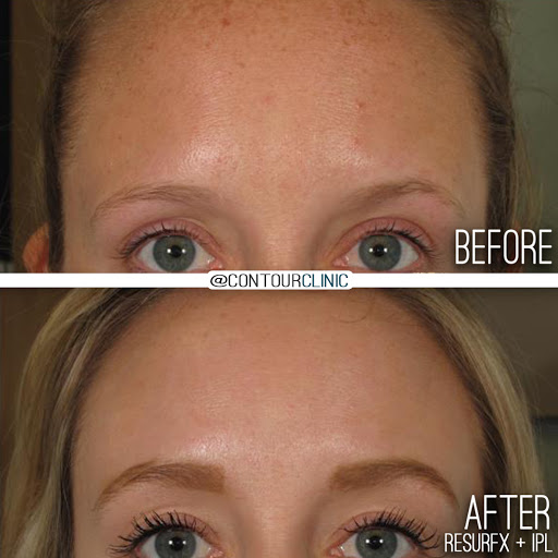 Medical Spa «Contour Clinic | Vadnais Heights», reviews and photos, 1058 Centerville Cir, Vadnais Heights, MN 55127, USA