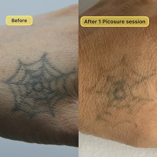 Explore good christian tattoo ideas, creative tattoo ideas in New York, available at Ag2g Laser Tattoo Removal & MedSpa