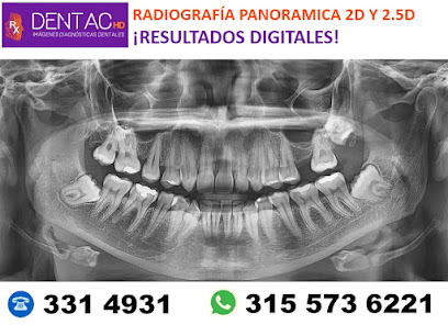 DENTAC HD Imágenes Diagnósticas Dentales