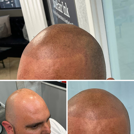 Explore icarus tattoo ideas, creative tattoo ideas in Roseville, available at NuHair Ink. Scalp MicroPigmentation & Aesthetic Clinic of Sacramento
