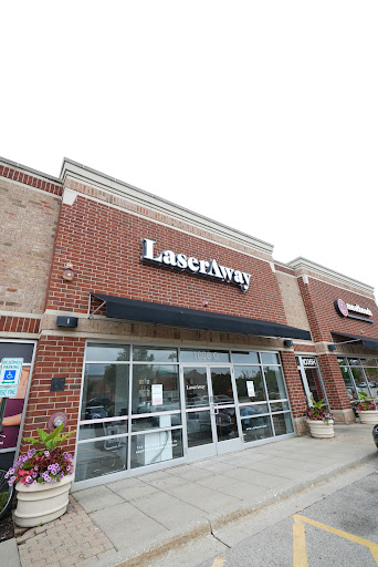Explore little brother tattoo ideas, creative tattoo ideas in Northbrook, available at LaserAway