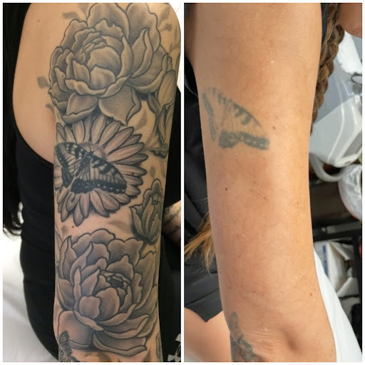 Explore dog ears tattoo ideas, creative tattoo ideas in San Antonio, available at MEDermis Tattoo Removal