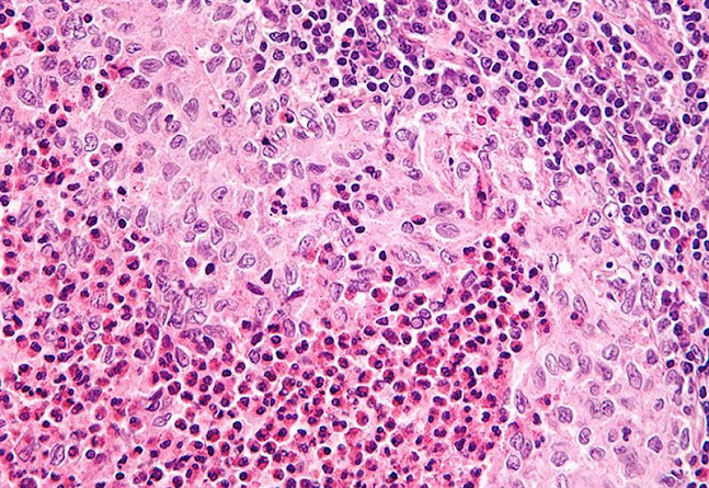 Opinii despre Langerhans szigetek în Debrecen - Élelmiszerüzlet