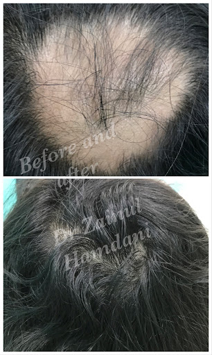 Dr Zainulabedin Hamdani (Best Dermatologist, Cosmetologist, Skin Specialist & Hair Specialist)Zafeerah Skin Clinic , PRP Treatment, Hair Loss Treatment