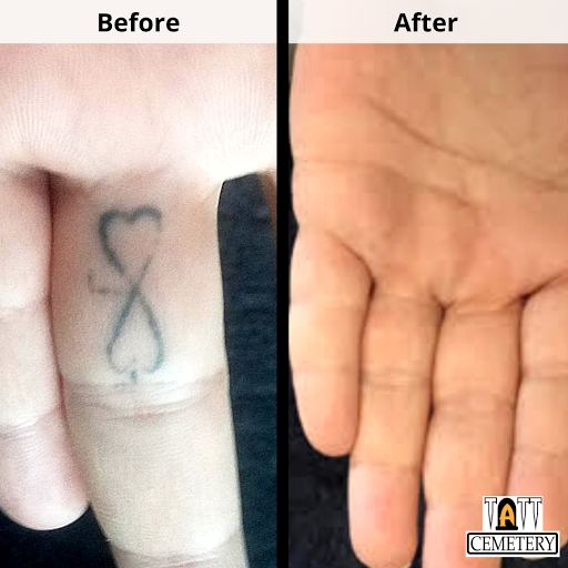 Explore colorado flag tattoo ideas, creative tattoo ideas in Fort Myers, available at Laser Tattoo Removal by Tatt Cemetery