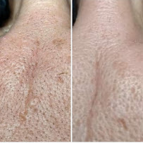 Serenity Skin Spa By Amber - Photo 4 - Car repair in Antioch, CA, Antioch