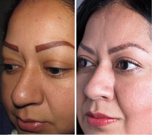 Hair Transplantation Clinic «Bosley Medical - Dallas», reviews and photos, 5949 Sherry Ln #1150, Dallas, TX 75225, USA