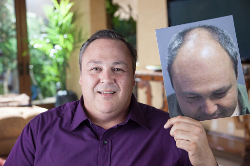 Hair Transplantation Clinic «Bosley Medical - Atlanta», reviews and photos, 3379 Peachtree Rd NE #800, Atlanta, GA 30326, USA