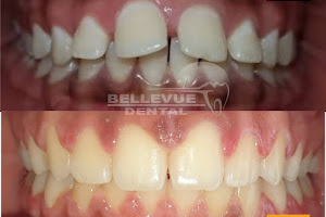 Bellevue Dental Clinic image