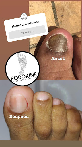 Podología Clínica Podokine