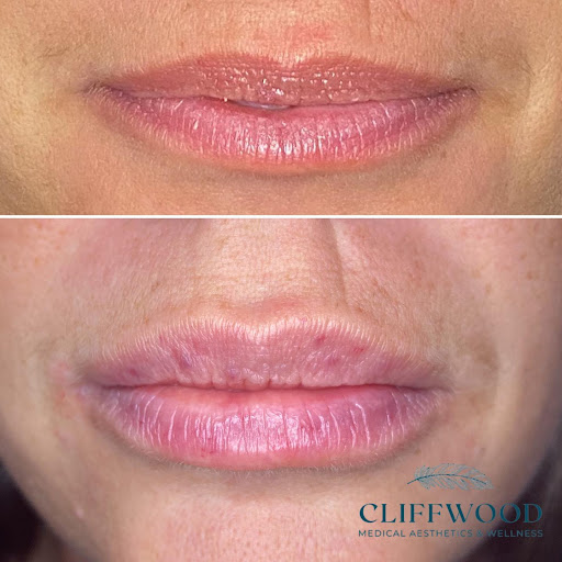 Explore just breathe tattoo ideas, creative tattoo ideas in Bristol, available at Cliffwood Medical Aesthetics and Wellness