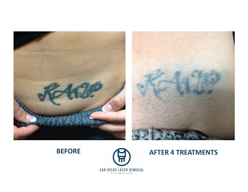 Explore music sleeve tattoo ideas, creative tattoo ideas in San Diego, available at Removery Tattoo Removal & Fading