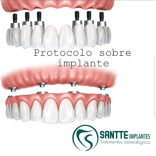 Logo da empresa - Santte Implantes