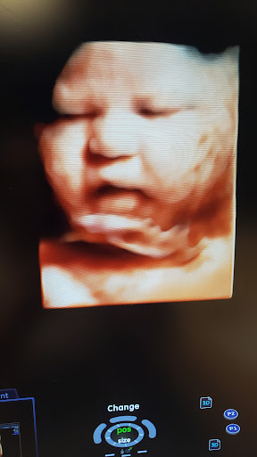 Baby Wave 4D Ultrasound image
