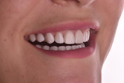 Dental Net تركيا - Dental Net Turkey