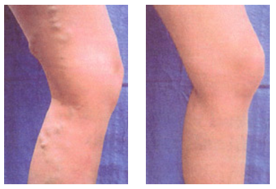 Explore ffxiv tattoo ideas, creative tattoo ideas in Sterling Heights, available at Skin & Vein Center