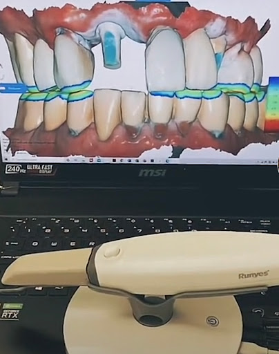 Implantes Dentales 3D Dra. Lissette Cairo