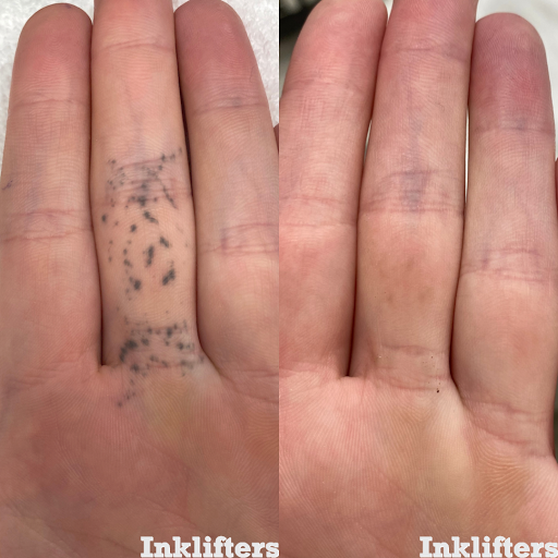 Explore daffodil tattoo ideas, creative tattoo ideas in Pleasant Grove, available at Inklifters Tattoo Removal