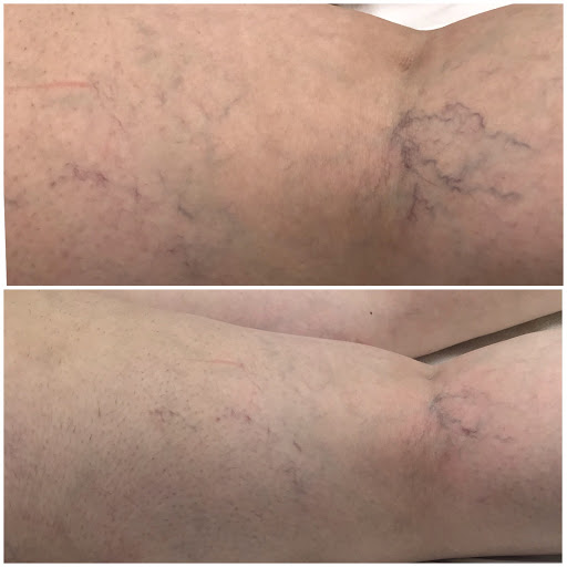 Explore luigi tattoo ideas, creative tattoo ideas in Middle Village, available at Bye Bye Ink Laser Tattoo Removal