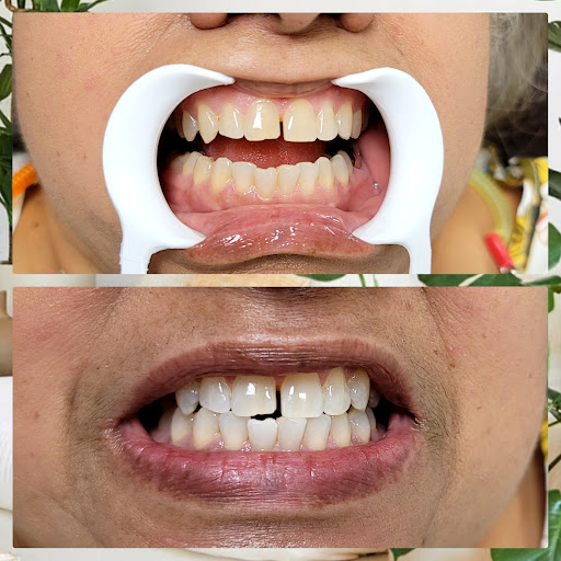 Explore naruto tattoos ideas, creative tattoo ideas in Bakersfield, available at Skin Kings Tattoo