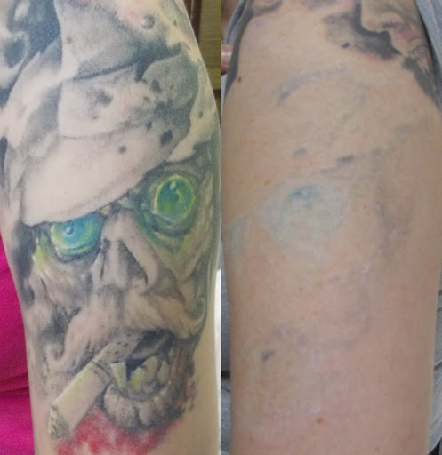 Explore mom tattoo ideas for sons, creative tattoo ideas in Weatherford, available at Vanish Laser Tattoo Removal and Skin Aesthetics