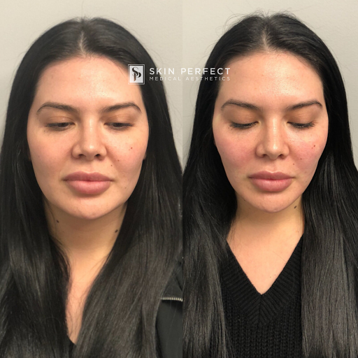 Explore simple colorado tattoo ideas, creative tattoo ideas in Whittier, available at Skin Perfect Medical Aesthetics