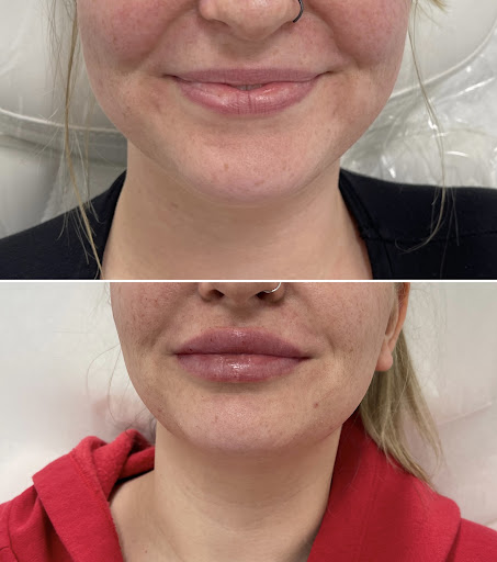 Explore how to find tattoo ideas, creative tattoo ideas in Owensboro, available at The Skin Lab