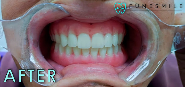 Funesmile Dental Clinic - Funesmile Dental Clinic