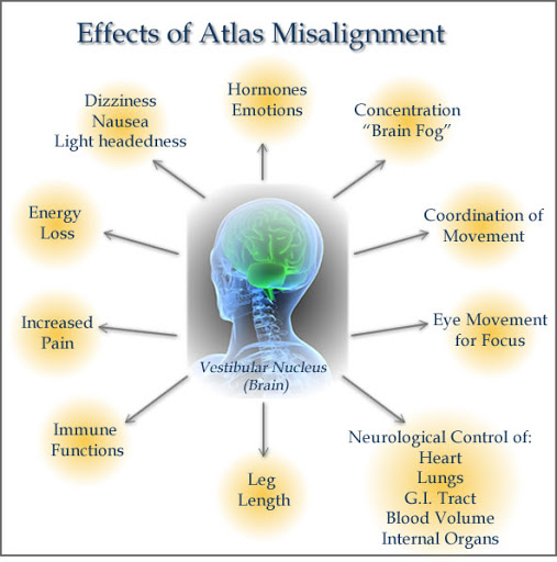 Carlsbad Atlas Chiropractic - Dr. Mark Van Doren, DC