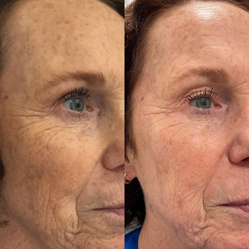 Explore tattoo ideas of strength, creative tattoo ideas in Owensboro, available at The Skin Lab