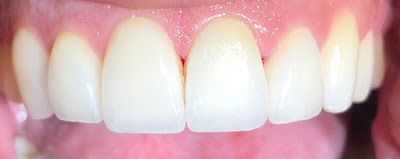 Dr Georgel Camille Dentiste Montpellier - Implantologue - Implant dentaire - parodontie - facettes esthétiques à Montpellier