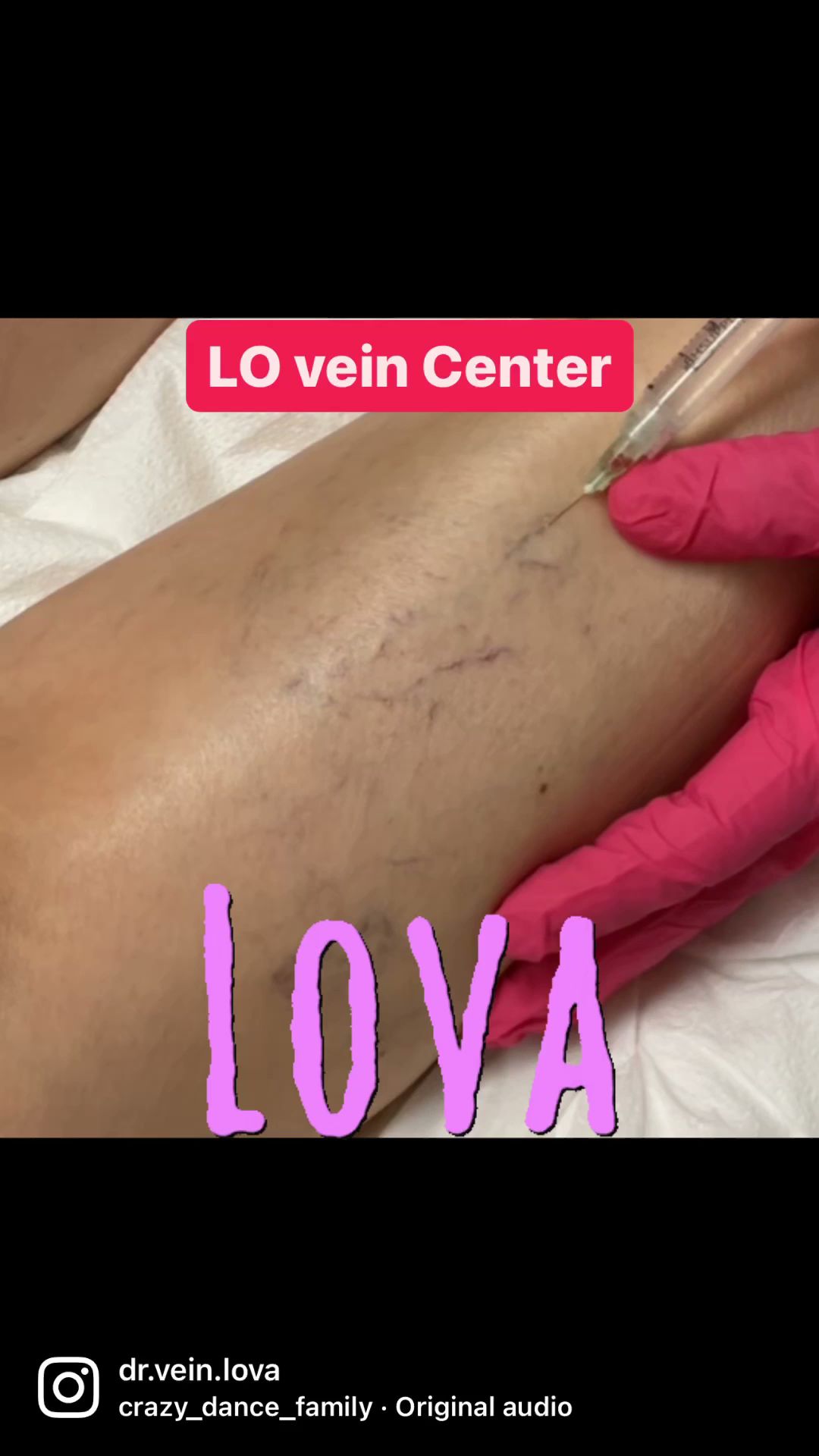 Lake Oswego Vein and Aesthetic LOVA