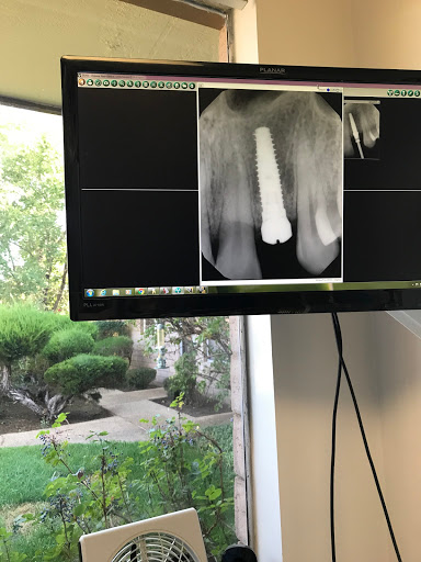Dental implants periodontist Reno