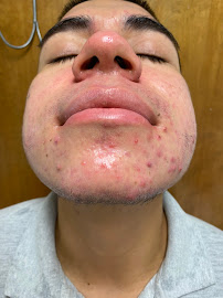 Newd Skin - Photo 9 - Car repair in Bakersfield, CA, Bakersfield