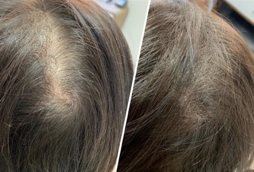 Explore smurf tattoo ideas, creative tattoo ideas in Conroe, available at Institute 28